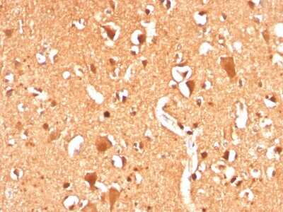 Immunohistochemistry-Paraffin: Ubiquitin B Antibody (UBB/3143R) [NBP3-07165]