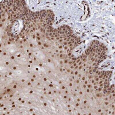 Immunohistochemistry-Paraffin: Ubiquitin C Antibody [NBP2-54692]