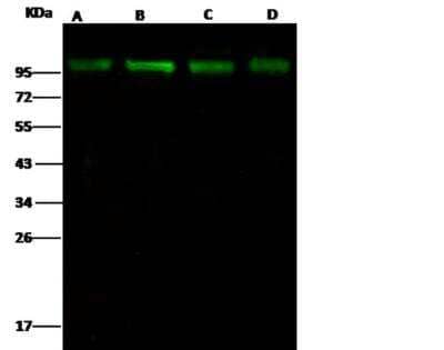 Western Blot: Ubiquitin-activating Enzyme/UBE1 Antibody (05) [NBP3-05789]