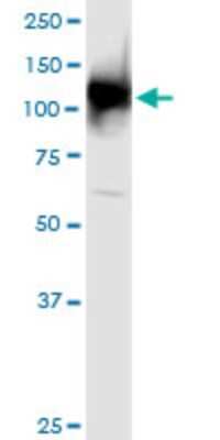 Western Blot: Ubiquitin-activating Enzyme/UBE1 Antibody (2B6) [H00007317-M02]