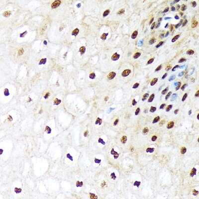 Immunohistochemistry-Paraffin: Ubiquitin-activating Enzyme/UBE1 Antibody (6H2I9) [NBP3-16792]