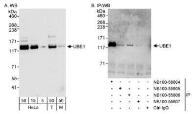 Western Blot: Ubiquitin-activating Enzyme/UBE1 Antibody [NB100-58804]