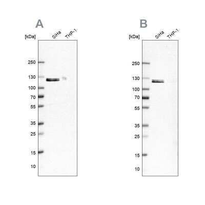 Western Blot: Ubiquitin-activating Enzyme/UBE1 Antibody [NBP1-90307]