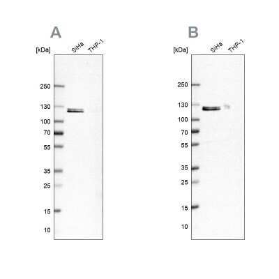 Western Blot: Ubiquitin-activating Enzyme/UBE1 Antibody [NBP2-76500]