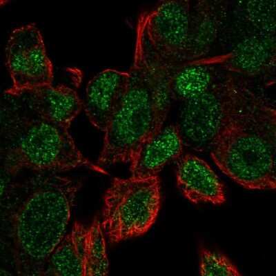 Immunocytochemistry/ Immunofluorescence: Uev1a/UBE2V1 Antibody [NBP2-57183]
