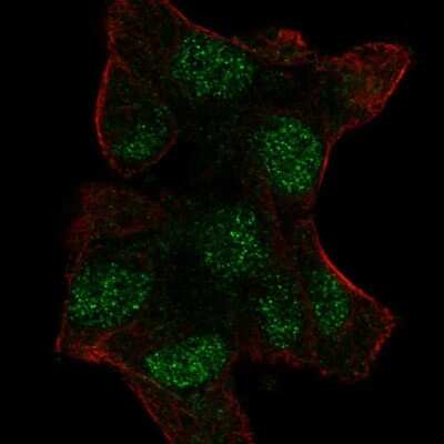 Immunocytochemistry/ Immunofluorescence: Uev1a/UBE2V1 Antibody [NBP2-58322]