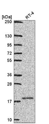 Western Blot: Uev1a/UBE2V1 Antibody [NBP2-57183]