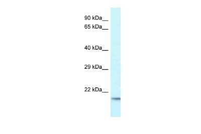 Western Blot: Uev1a/UBE2V1 Antibody [NBP2-88550]