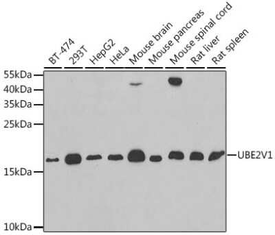 Western Blot: Uev1a/UBE2V1 AntibodyBSA Free [NBP3-05648]