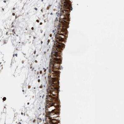 Immunohistochemistry-Paraffin: Ufc1 Antibody [NBP1-81677]