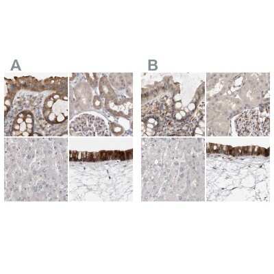 Immunohistochemistry-Paraffin: Ufc1 Antibody [NBP1-81677]