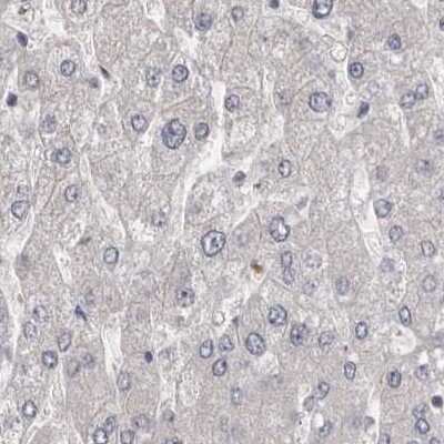 Immunohistochemistry-Paraffin: Ufc1 Antibody [NBP1-81677]