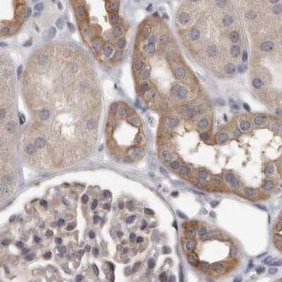 Immunohistochemistry-Paraffin: Ufc1 Antibody [NBP1-81677]