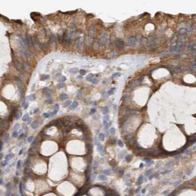 Immunohistochemistry-Paraffin: Ufc1 Antibody [NBP1-81677]