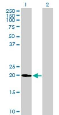 Western Blot: Ufc1 Antibody [H00051506-B01P]