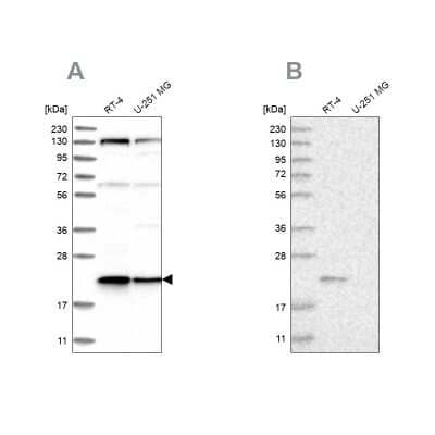 Western Blot: Ufc1 Antibody [NBP1-81676]