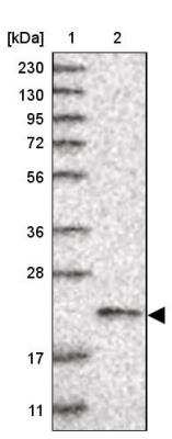 Western Blot: Ufc1 Antibody [NBP1-81677]