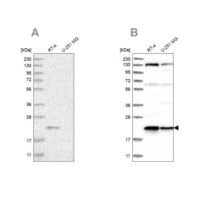 Western Blot: Ufc1 Antibody [NBP1-81677]