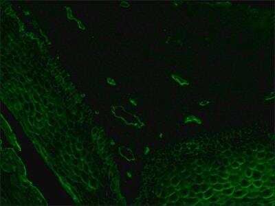Immunohistochemistry: Ulex Europaeus Lectin 1 Antibody [NB110-13922]