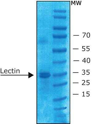 SDS-PAGE: Ulex Europaeus Lectin 1 Native Protein [NBP2-42700]