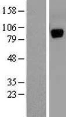 Western Blot: UNC5H1/Unc5a Overexpression Lysate [NBL1-17616]