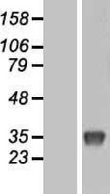 Western Blot: Uridine Phosphorylase 1/UPP1 Overexpression Lysate [NBL1-17625]