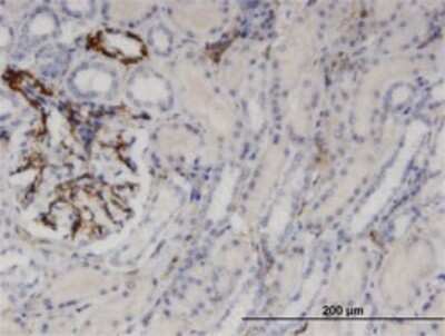 Immunohistochemistry-Paraffin: Uridine Phosphorylase 1/UPP1 Antibody (2F5) [H00007378-M01]