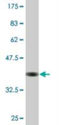 Western Blot: Uridine Phosphorylase 1/UPP1 Antibody (2F5) [H00007378-M01]