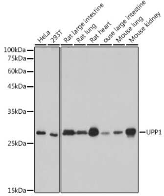 Western Blot: Uridine Phosphorylase 1/UPP1 Antibody (3E2I2) [NBP3-15285]