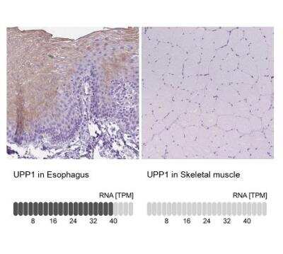 Immunohistochemistry-Paraffin: Uridine Phosphorylase 1/UPP1 Antibody [NBP2-30852]