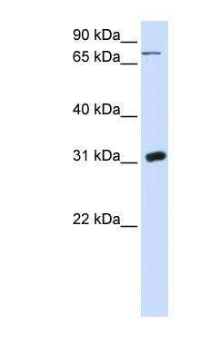 Western Blot: Uridine Phosphorylase 1/UPP1 Antibody [NBP1-55354]