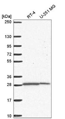 Western Blot: Uridine Phosphorylase 1/UPP1 Antibody [NBP2-58229]