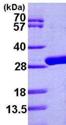 SDS-PAGE: Recombinant E. coli Uridine Phosphorylase 1/UPP1 His Protein [NBP1-46053]