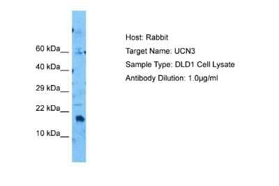 Western Blot: Urocortin 3 Antibody [NBP2-86045]