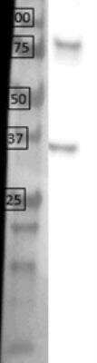 Western Blot: Urocortin Antibody (2D7) [NBP2-62804]