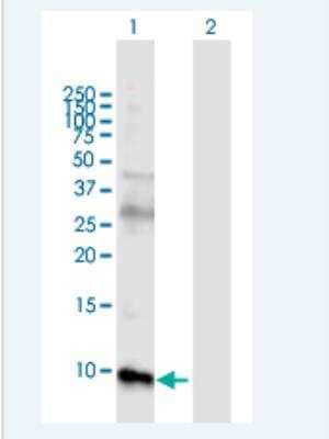 Western Blot: Uroguanylin Antibody [H00002981-B01P-50ug]