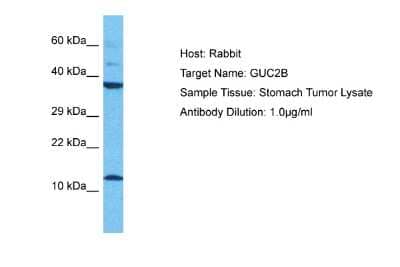 Western Blot: Uroguanylin Antibody [NBP2-86888]