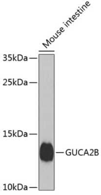 Western Blot: Uroguanylin AntibodyBSA Free [NBP2-94611]