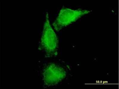 Immunocytochemistry/ Immunofluorescence: Uromodulin Antibody [H00007369-B01P]