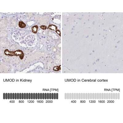 Immunohistochemistry-Paraffin: Uromodulin Antibody [NBP2-33393]