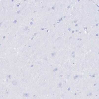 Immunohistochemistry-Paraffin: Uromodulin Antibody [NBP2-33730]