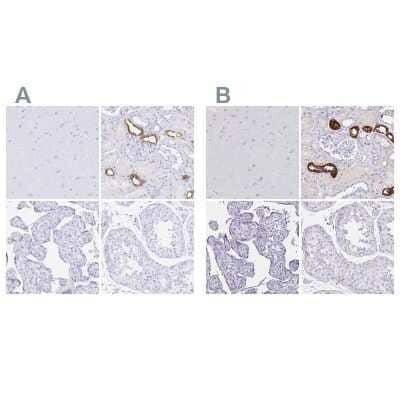 Immunohistochemistry-Paraffin: Uromodulin Antibody [NBP2-33730]