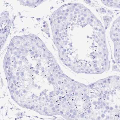 Immunohistochemistry-Paraffin: Uromodulin Antibody [NBP2-33730]
