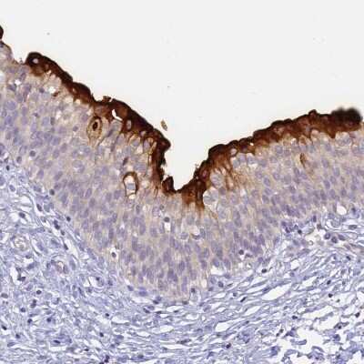 Immunohistochemistry-Paraffin: Uroplakin II Antibody [NBP2-33389]