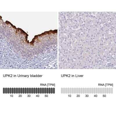 Immunohistochemistry-Paraffin: Uroplakin II Antibody [NBP2-33389]