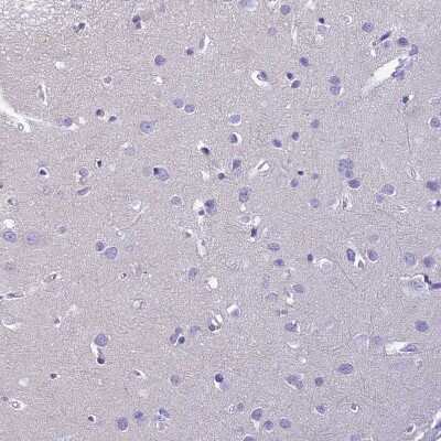 Immunohistochemistry-Paraffin: Uroplakin II Antibody [NBP2-33389]