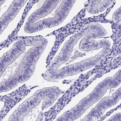 Immunohistochemistry-Paraffin: Uroplakin II Antibody [NBP2-33389]