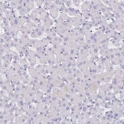 Immunohistochemistry-Paraffin: Uroplakin II Antibody [NBP2-33389]