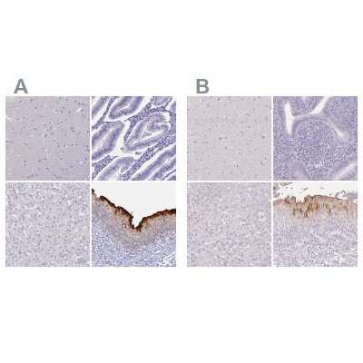 Immunohistochemistry-Paraffin: Uroplakin II Antibody [NBP2-33389]