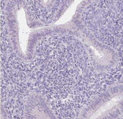 Immunohistochemistry-Paraffin: Uroplakin II Antibody [NBP2-38904]
